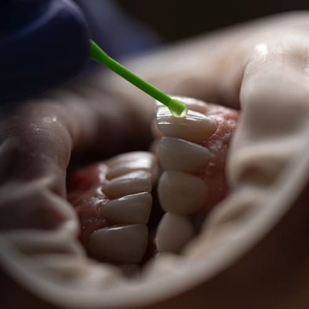 Periodoncia en Córdoba Periodoncia en Córdoba